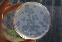 Por que as superbactérias são uma ameaça?